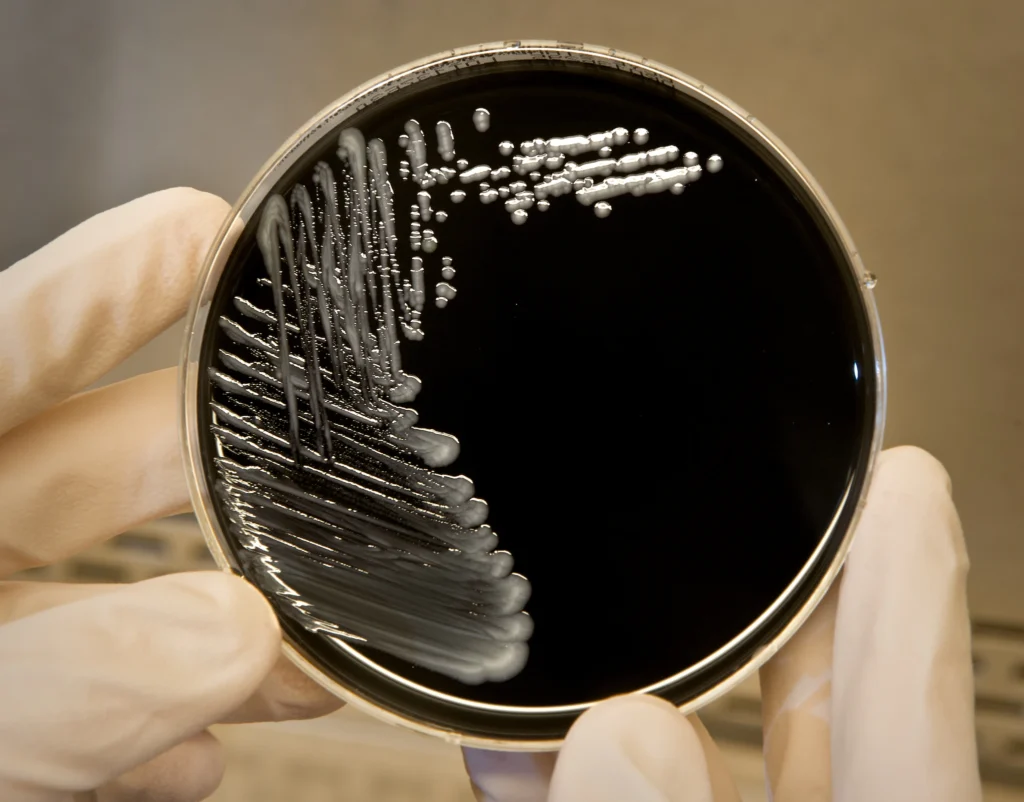 a hand holding a petri dish with white lines on it